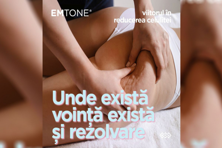 Secretele siluetelor impecabile ale modelelor Victoria's Secret - acum și în Moldova la Synergy Studio - VIDEO Secretele siluetelor impecabile ale modelelor Victoria's Secret - acum și în Moldova la Synergy Studio - VIDEO