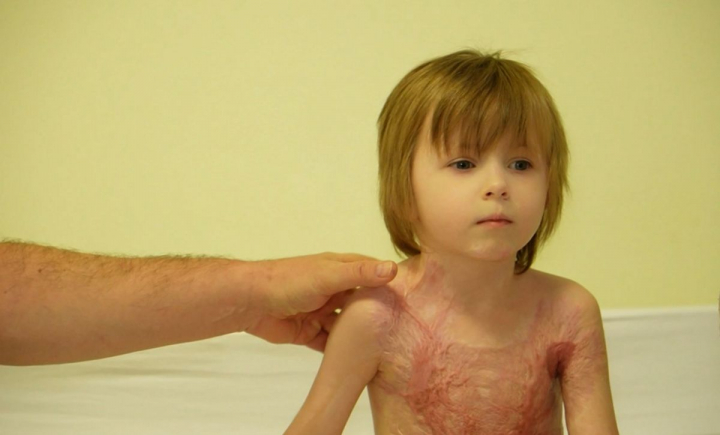 DĂRUIEȘTI ȘI CÂȘTIGI: La doar patru ani, Viviana îndură prea multe pentru vârsta ei. În urma unui accident, copila a suferit arsuri pe mai bine de jumătate din suprafața corpului, iar acum are nevoie de operații estetice - VIDEO DĂRUIEȘTI ȘI CÂȘTIGI: La doar patru ani, Viviana îndură prea multe pentru vârsta ei. În urma unui accident, copila a suferit arsuri pe mai bine de jumătate din suprafața corpului, iar acum are nevoie de operații estetice - VIDEO