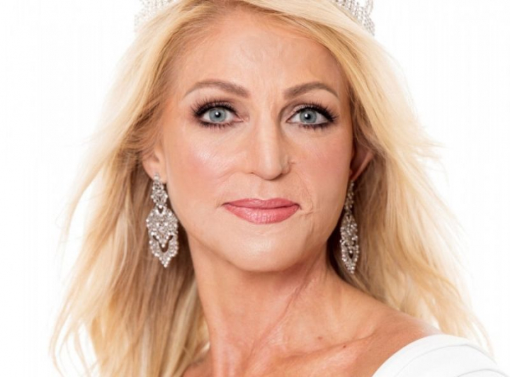 Cum a ajuns o femeie să fie desemnată regină a frumuseții după ce chipul i-a fost distrus în urma unei explozii: „Nu am renunțat!”
Cum a ajuns o femeie să fie desemnată regină a frumuseții după ce chipul i-a fost distrus în urma unei explozii: „Nu am renunțat!”