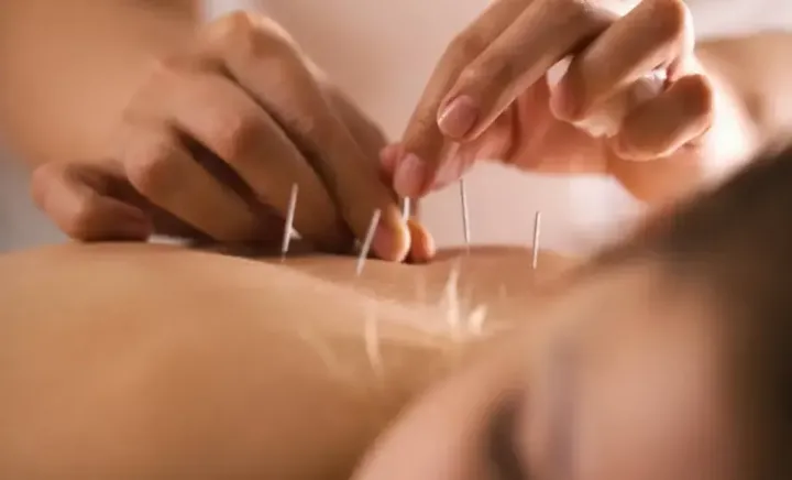 Acupunctura - una dintre cele mai vechi practici de tratament din lume! Care sunt beneficiile, dar și contraindicațiile ei, a explicat medicul Natalia Jalbă - VIDEO Acupunctura - una dintre cele mai vechi practici de tratament din lume! Care sunt beneficiile, dar și contraindicațiile ei, a explicat medicul Natalia Jalbă - VIDEO