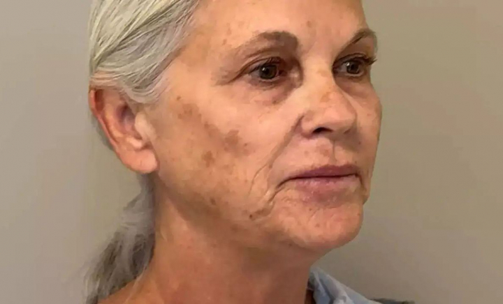 Nouă intervenții estetice, în șase ore, la 65 de ani. Transformarea unei femei e uimitoare: „Mi-am recăpătat încrederea” Nouă intervenții estetice, în șase ore, la 65 de ani. Transformarea unei femei e uimitoare: „Mi-am recăpătat încrederea”