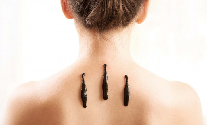 Terapia cu lipitori, o metodă veche cu beneficii moderne! Află de la specialistul în hirudoterapie, Elena Negară, în ce cazuri este recomandată - VIDEO Terapia cu lipitori, o metodă veche cu beneficii moderne! Află de la specialistul în hirudoterapie, Elena Negară, în ce cazuri este recomandată - VIDEO