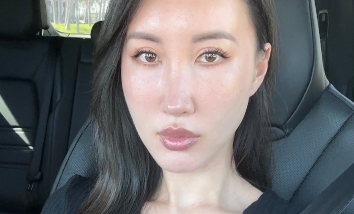 Adevărul despre operațiile estetice. Ce spune o tânără care a cheltuit peste 120 de mii de dolari pe intervenții faciale - FOTO Adevărul despre operațiile estetice. Ce spune o tânără care a cheltuit peste 120 de mii de dolari pe intervenții faciale - FOTO