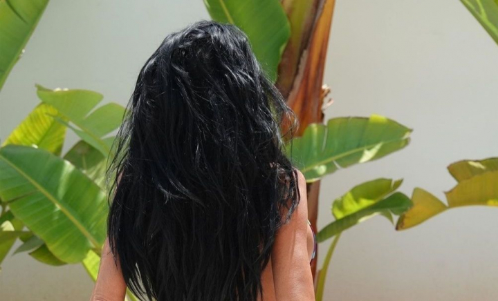 Și-a dorit un posterior „de braziliancă”, dar rezultatul a fost dezastruos. Vedeta, în agonie după ultima intervenție estetică Și-a dorit un posterior „de braziliancă”, dar rezultatul a fost dezastruos. Vedeta, în agonie după ultima intervenție estetică