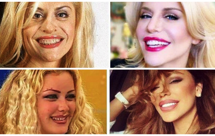 Vedetele, inainte sa-si repare dantura! Ieri, zambet de matusica, azi, de papusica! Cat de mult s-a schimbat zambetul lor - FOTO Vedetele, inainte sa-si repare dantura! Ieri, zambet de matusica, azi, de papusica! Cat de mult s-a schimbat zambetul lor - FOTO