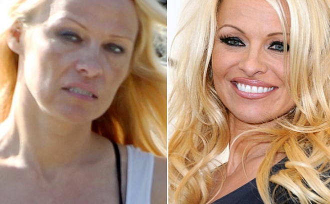 Sex simbolul Pamela Anderson a decazut la maxim. Diva s-a ingrasat si are o groaza de cicatrici de la operatiile estetice - FOTO Sex simbolul Pamela Anderson a decazut la maxim. Diva s-a ingrasat si are o groaza de cicatrici de la operatiile estetice - FOTO