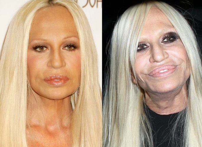  Donatella Versace arata groaznic! Afla motivul ce a distrus-o timp de 40 de ani - FOTO
