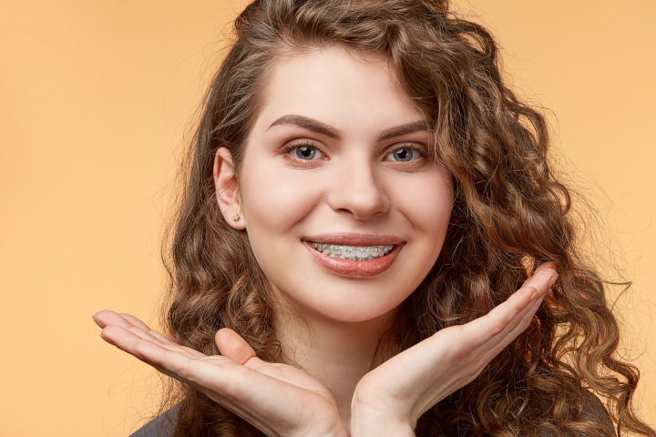 Tendinta in stomatologie: brackets colorati! Ai avea curajul sa porti asa ceva? VIDEO