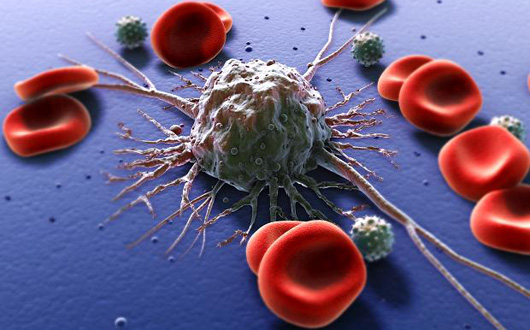 Semne ca poti face cancer si sfaturi sa-l eviti Semne ca poti face cancer si sfaturi sa-l eviti