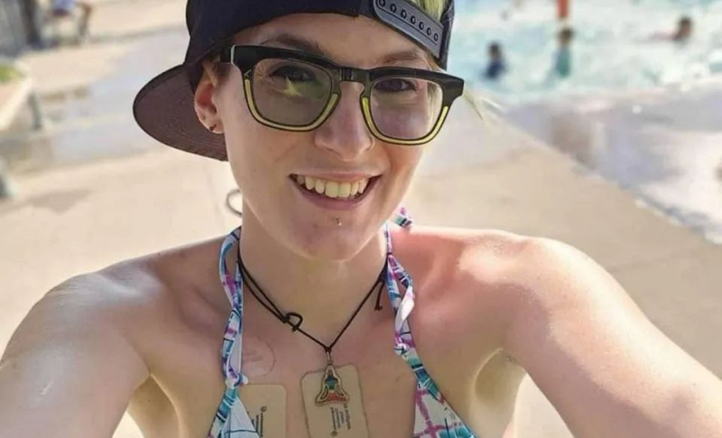 Boala rară de care suferă o femeie. Ar putea muri dacă mănâncă usturoi: „Sunt ca un vampir” - FOTO