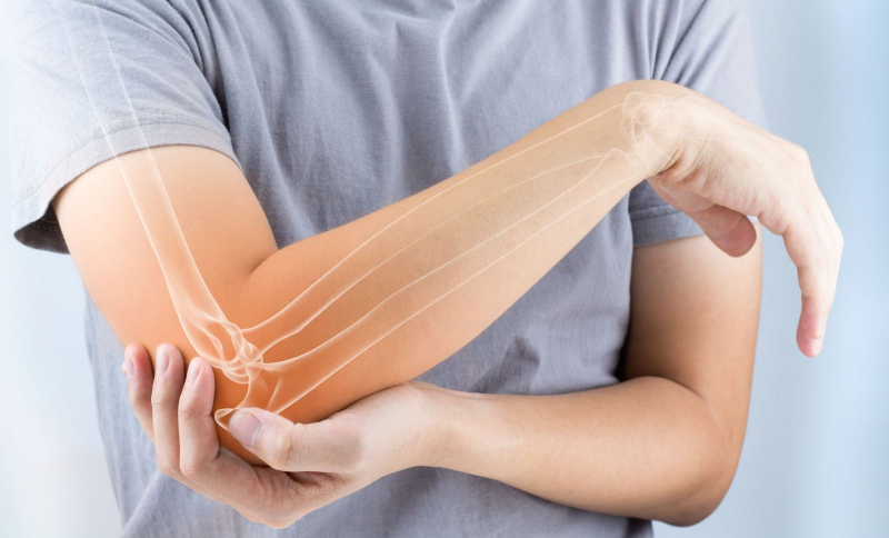 Tot ce trebuie să știi despre osteoporoză! Medicul reumatolog Ina Șevcenco explică cum îți poți proteja oasele și preveni fracturile după 50 de ani - VIDEO