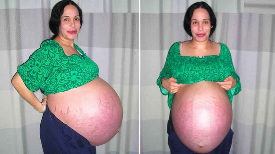 Cum arata octomama Nadya Suleman, la 11 ani dupa ce a nascut cei 8 copii. Are 14 in total!