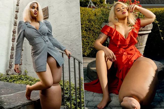 Uimitor! Cum traieste un model cu o tumoare de 50 de kilograme pe picior - FOTO