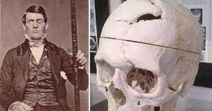 Cazul bizar al lui Phineas Gage, omul care a trait cu o gaura in cap