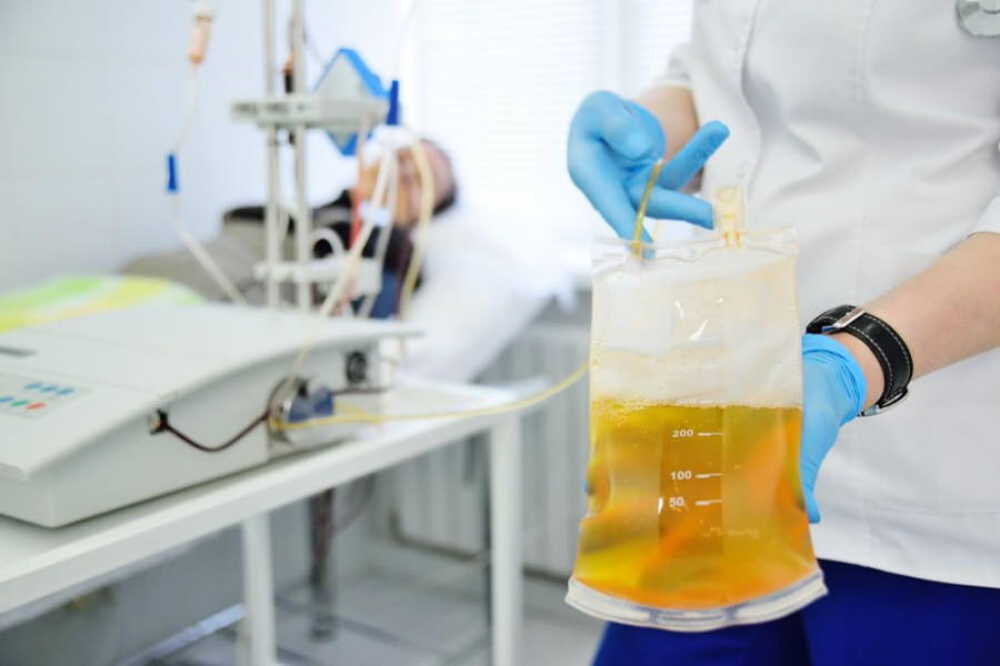 Plasmafereza, poate fi utilizata ca tratament sau ca procedura pentru donare de plasma