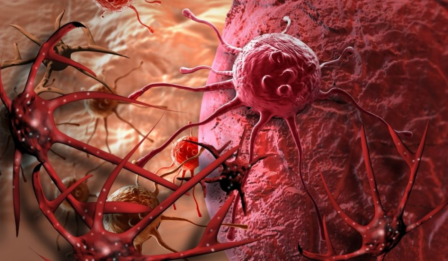 Un test „revolutionar” ar putea detecta riscul de a dezvolta patru tipuri de cancer la femei