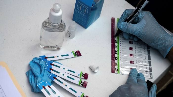 O noua varianta HIV, mai virulenta, identificata in Olanda