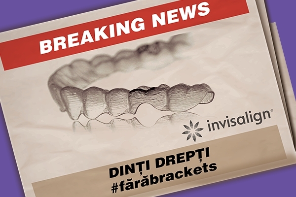 Dantura perfecta fara bracket?! In premiera pentru Moldova, Clinica Dentino propune un nou serviciu de indreptare a dintilor fara aparat dentar fix - VIDEO