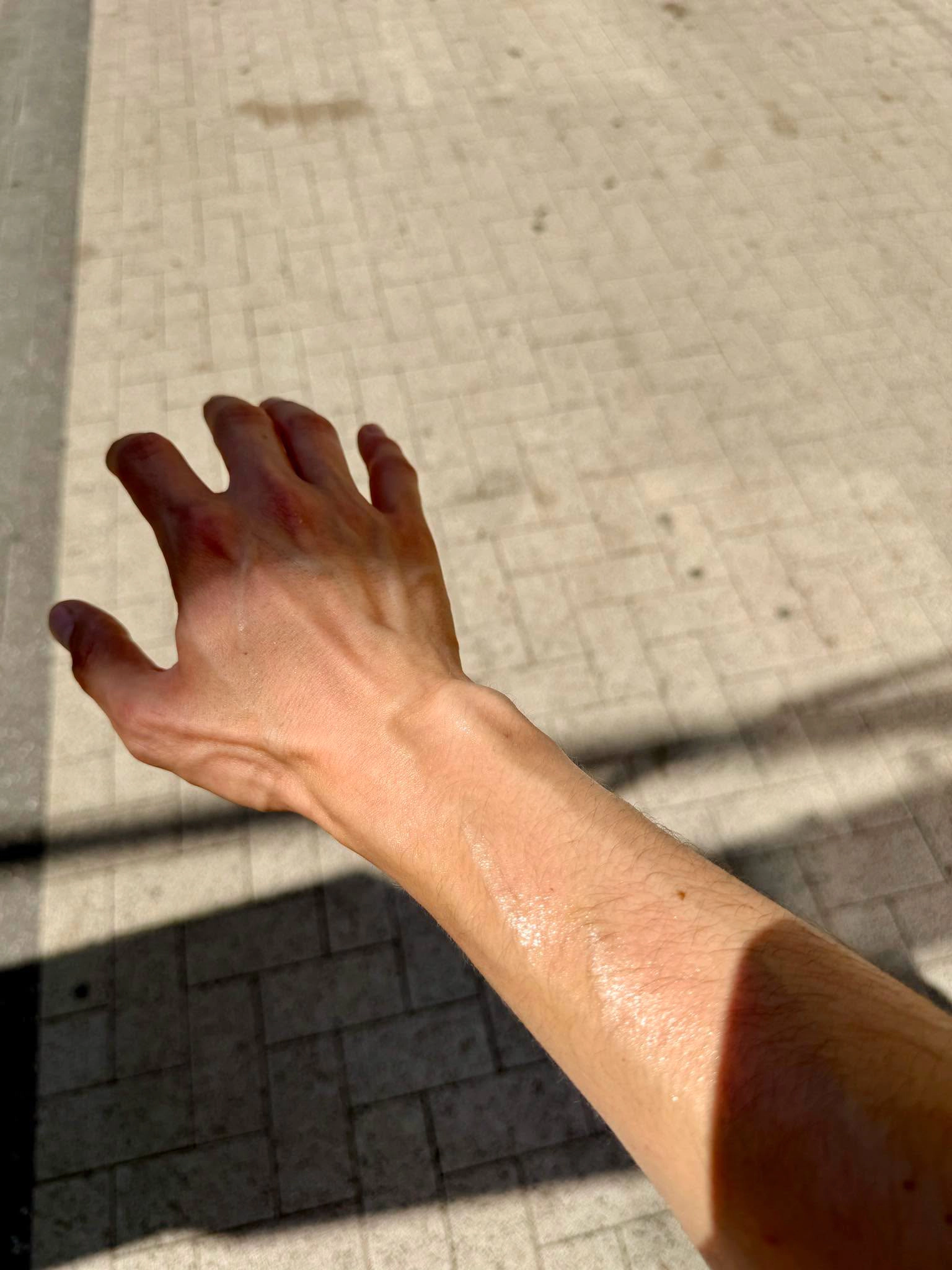 Un călător și-a fotografiat mâna după ce a ieșit din troleibuz