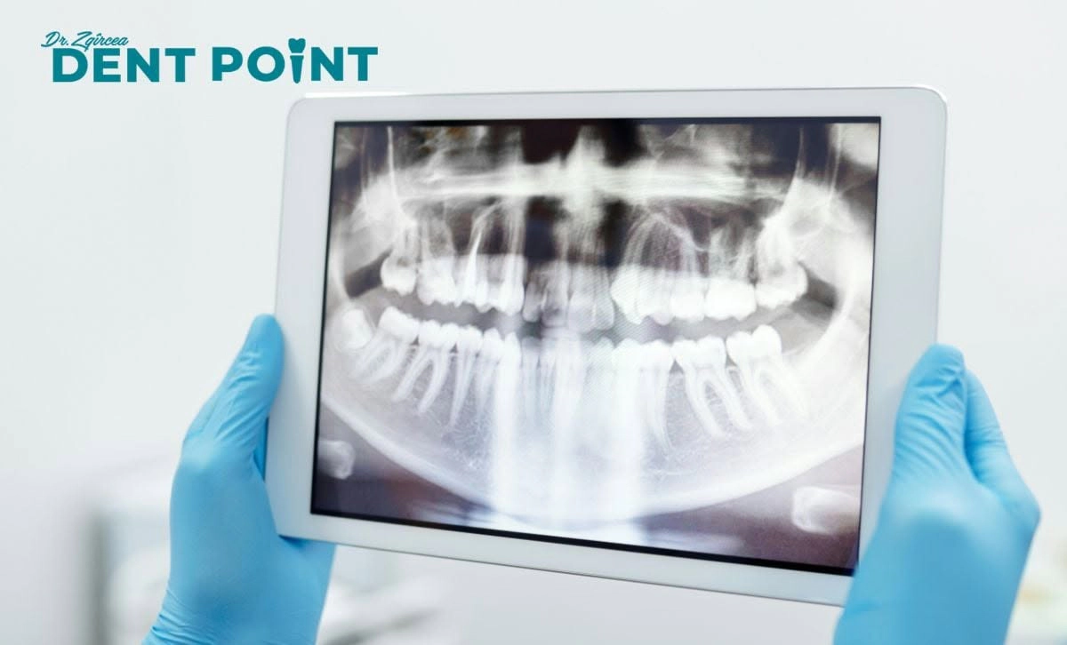 DentPoint
