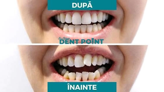 DentPoint