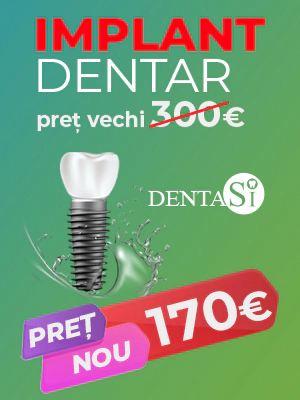 Implant dentar